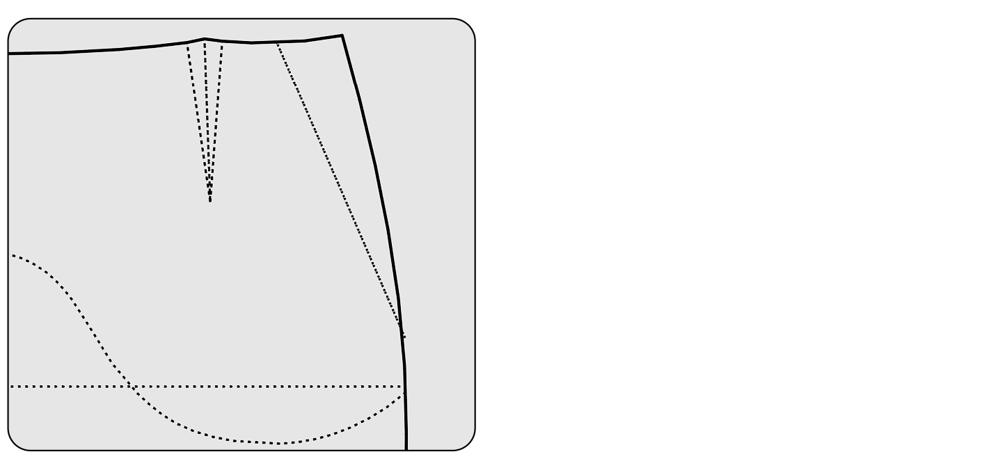 schräge Eingrifftasche Schnitttechnik