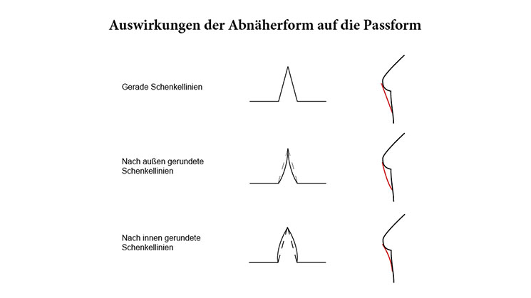 Die verschiedenen Formen der Abnähschenkel und deren Auswirkung auf die Passform .